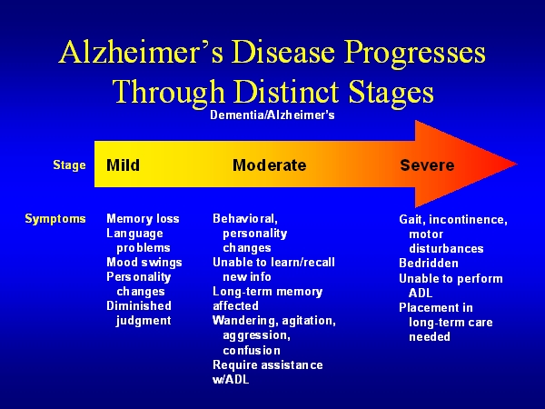 Alzheimers Stages Chart