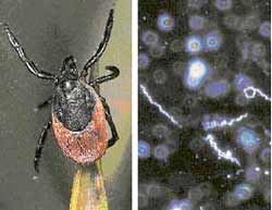 Borrelia