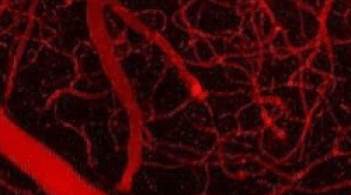 microscopic red veins