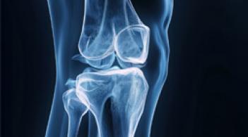 xray image of knee joint