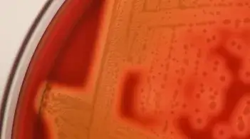 Bacteria growing on petri dish 