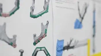 Visual rendering of jaw reconstruction 