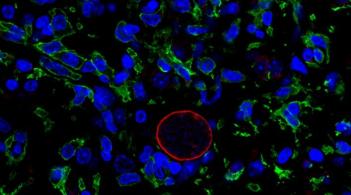 Infected microscopic cell