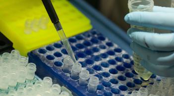 Scientist using a pipet 