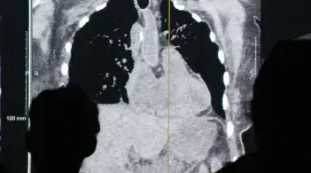 silhouette of people viewing a thorax xray