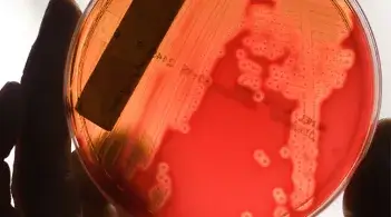 a bright orange substance in a petri dish