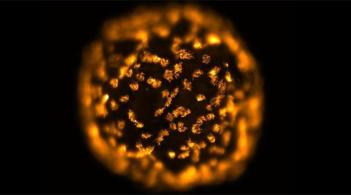 Each individual living robot develops into a sphere covered in cilia: thousands of waving hairs (seen here glowing orange) that act as tiny oars to propel them through their aqueous environment. 