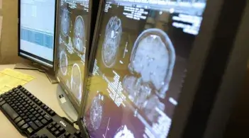 computer screens showing brain imaging