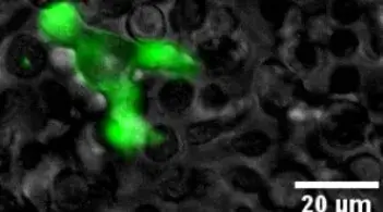 HIV-induced, small T cell syncytia