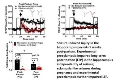 Seizure-induced injury in the hippocampus data charts.