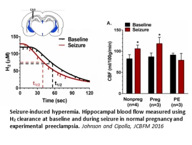 Seizure-induced hyperemia data charts.