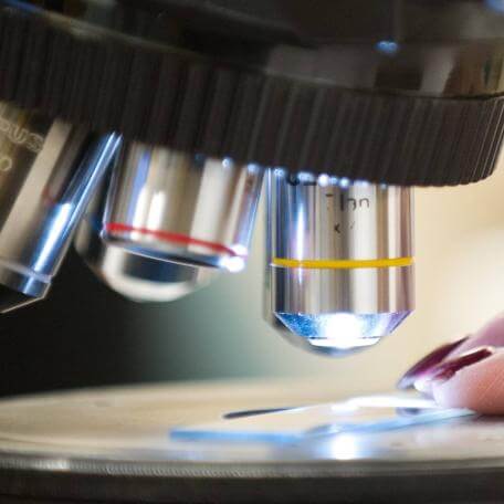 Close up of someone examining a slide on a microscope stage linking to Study Design and Molecular Epidemiology Core