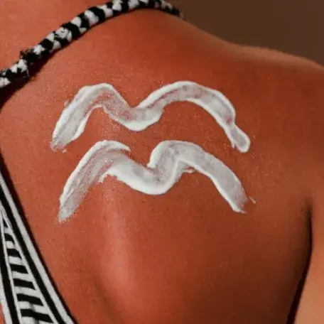 sunscreen on burnt skin