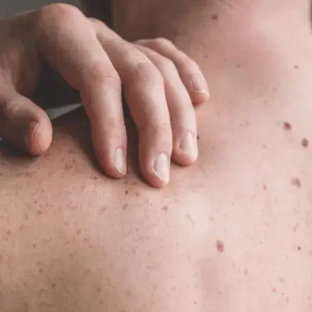 skin