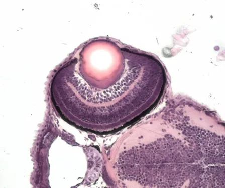 A microscope image of a zebrafish forebrain and the retina for a zebrafish undergoing normal development.