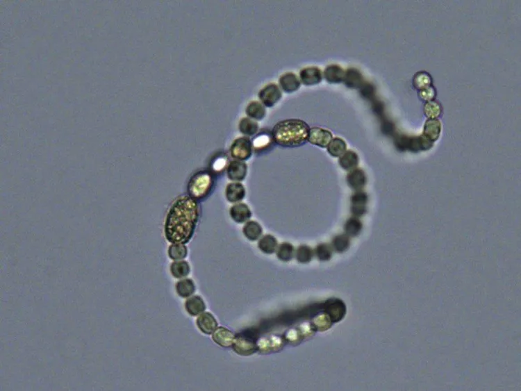 Microscope image of cyanobacteria