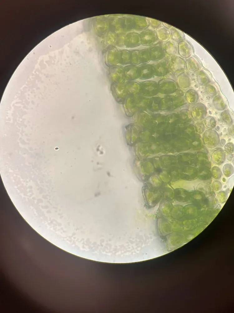 Moss under a microscope