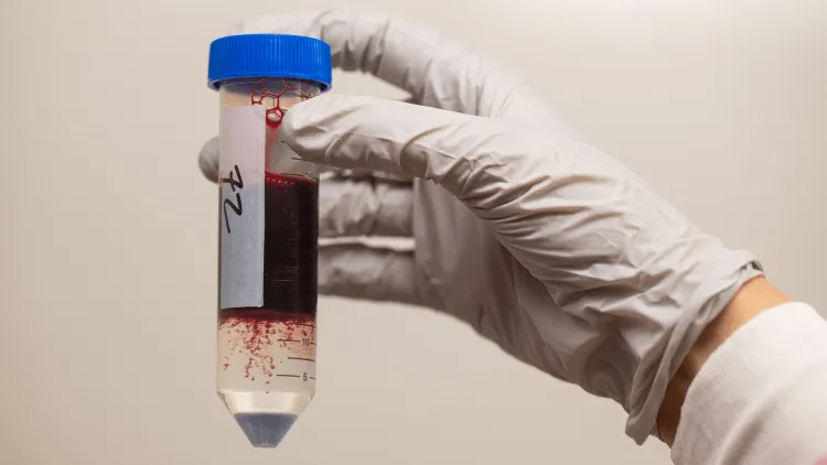 a gloved hand holding a vial of blood