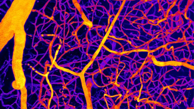 a colorful image of microvasculature of a brain