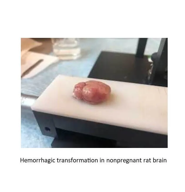 Hemorrhagic transformation in nonpregnant rat brain