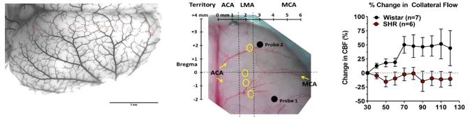 Vascular Protection for Acute Ischemic Stroke