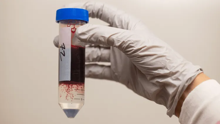 a vial of separated blood