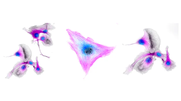 colorful images of melanomas