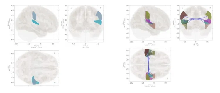 images of the brain showing connectivity