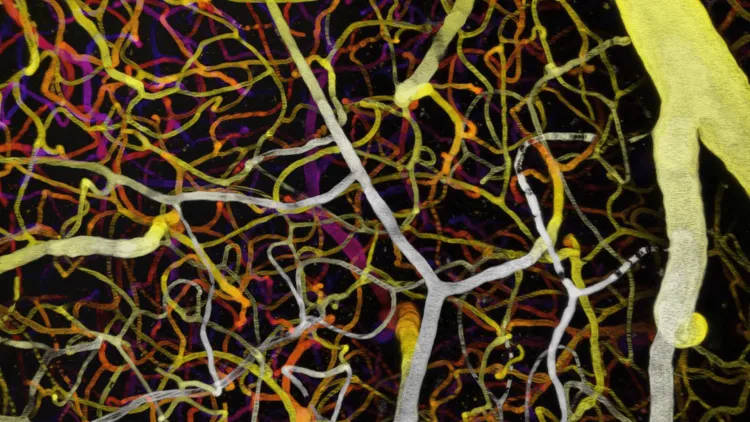 A vasculature image of a mouse brain