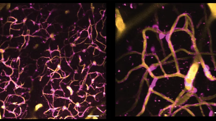 colorful magnified images of a brain cortex