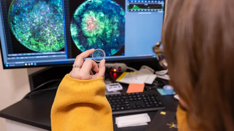 PhD student Audrey Clay-Streib holds a small dish containing a tissue sample whose fluorescence enhanced image of dynamic cell processes is displayed on the computer screen.