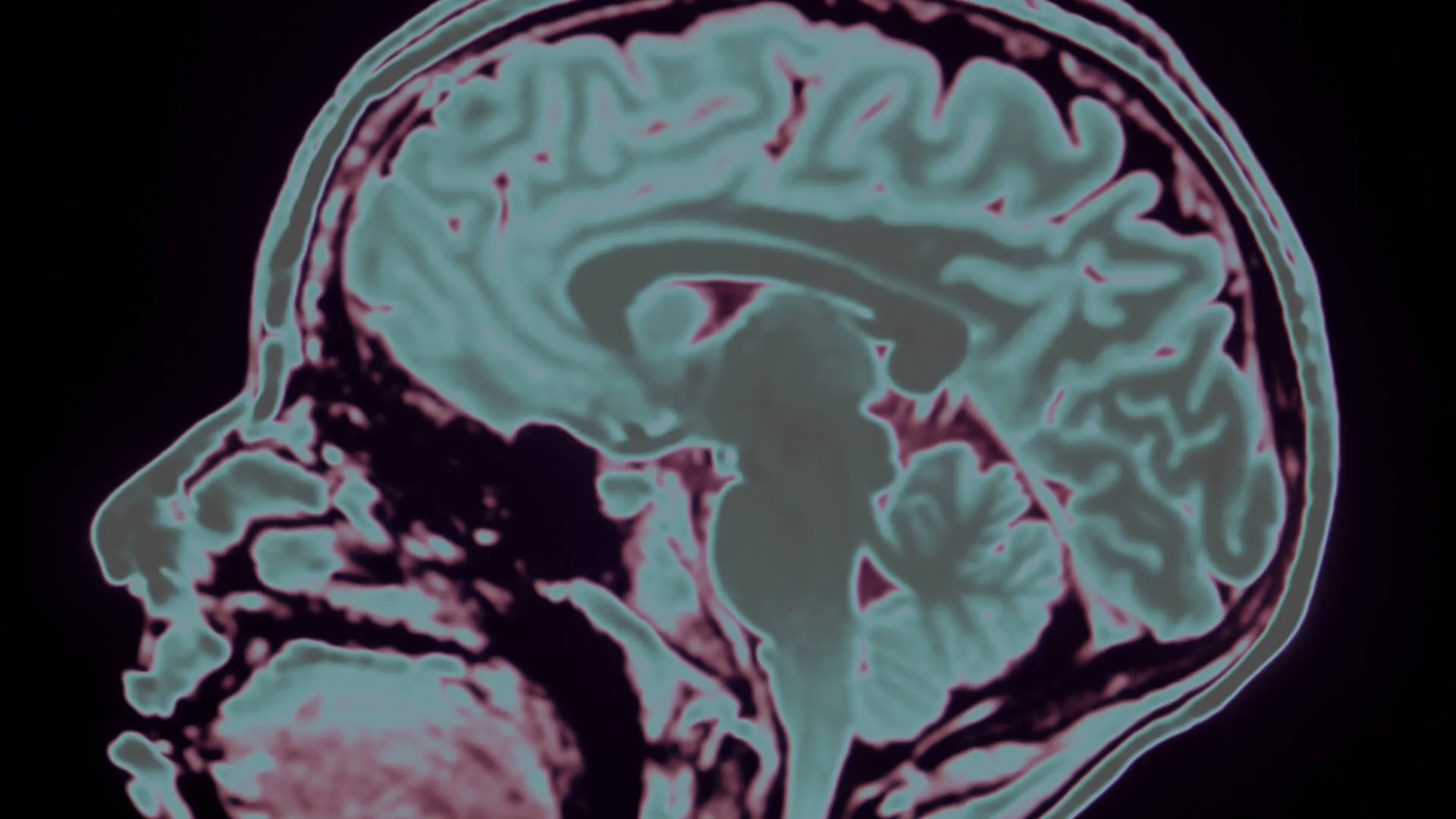 brain scan