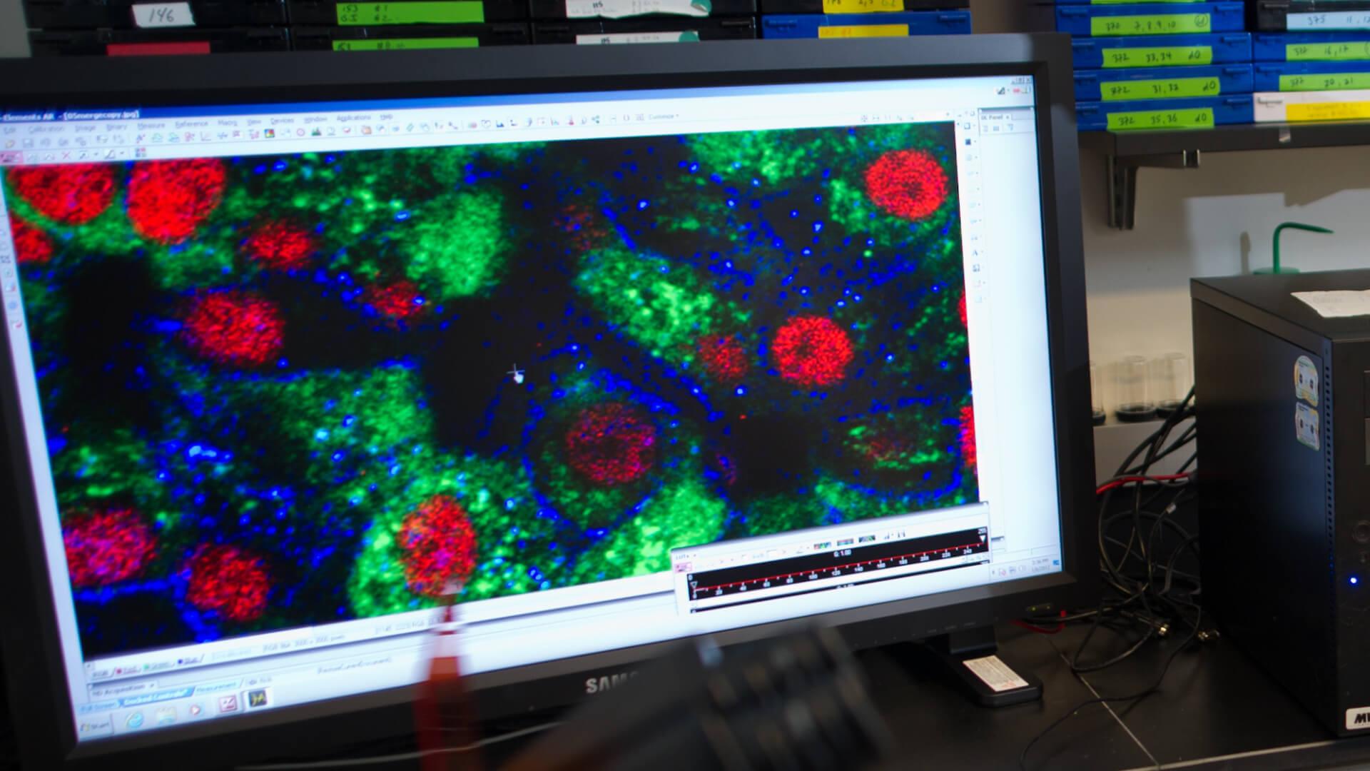 research image on computer screen
