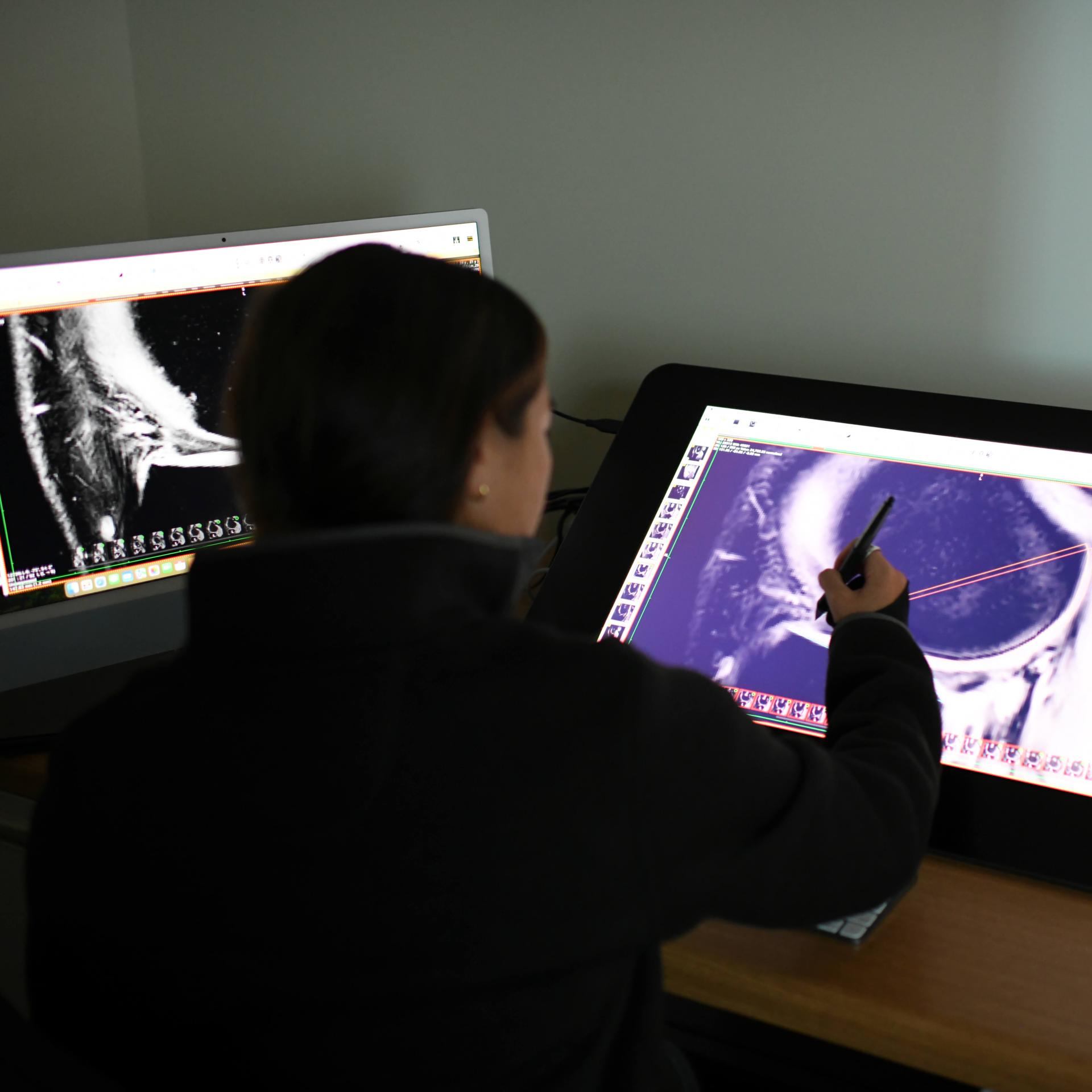 Student working on Musculoskeletal imaging lab