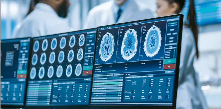 Computer screen with MRI image