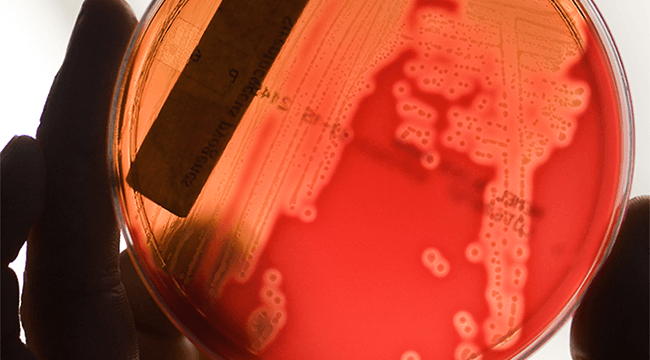 a bright orange substance in a petri dish