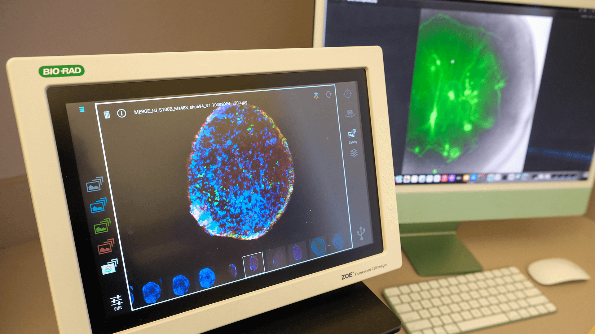 2 computer screens showing colorful brain images