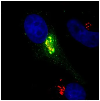 Microscopic view of genes