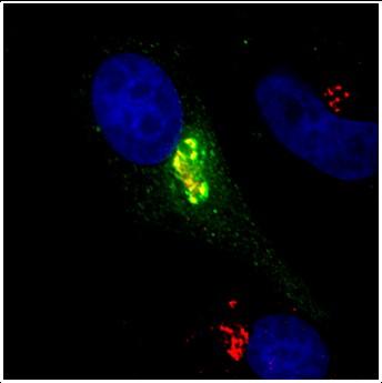 Microscopic view of genes