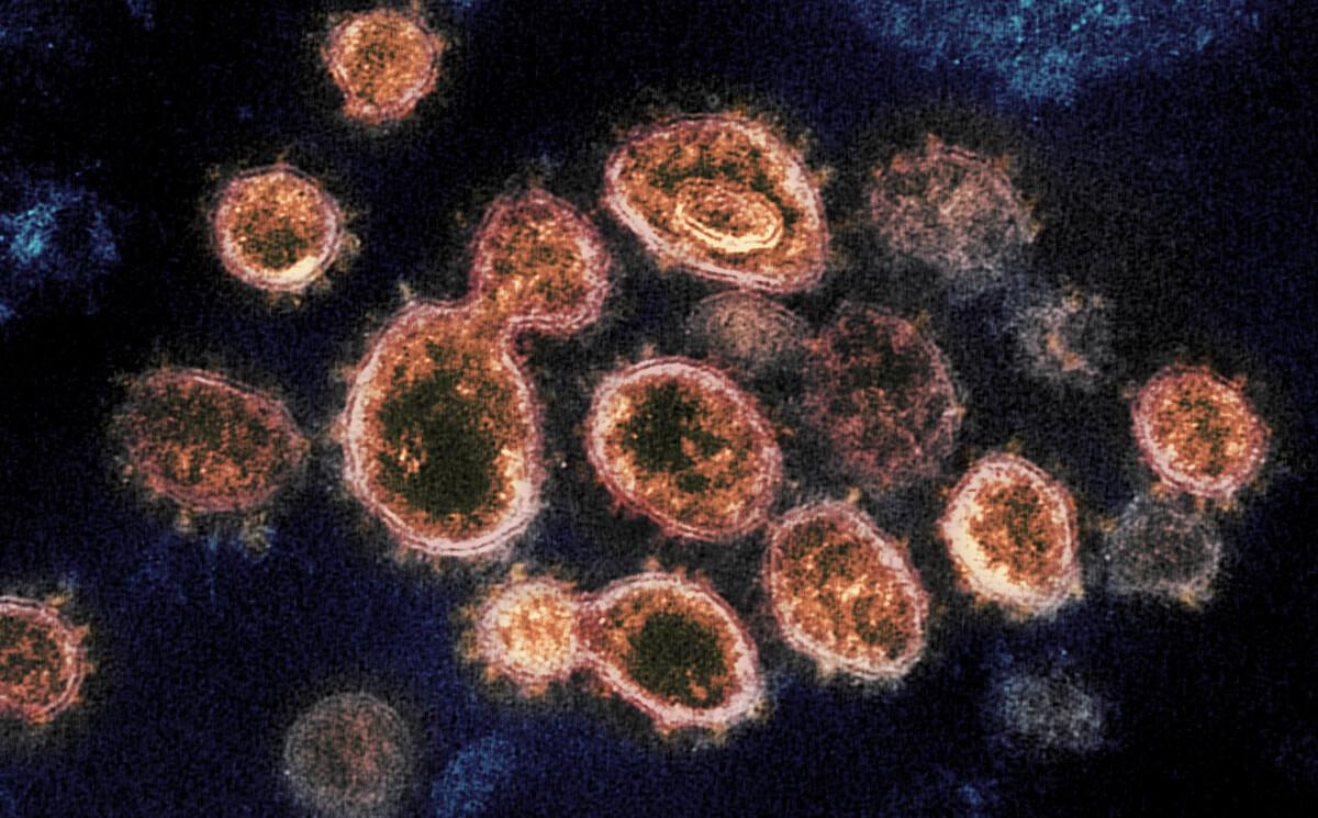 Microscope image of illuminated cells on a black background