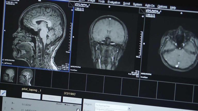 Image of human brain scans