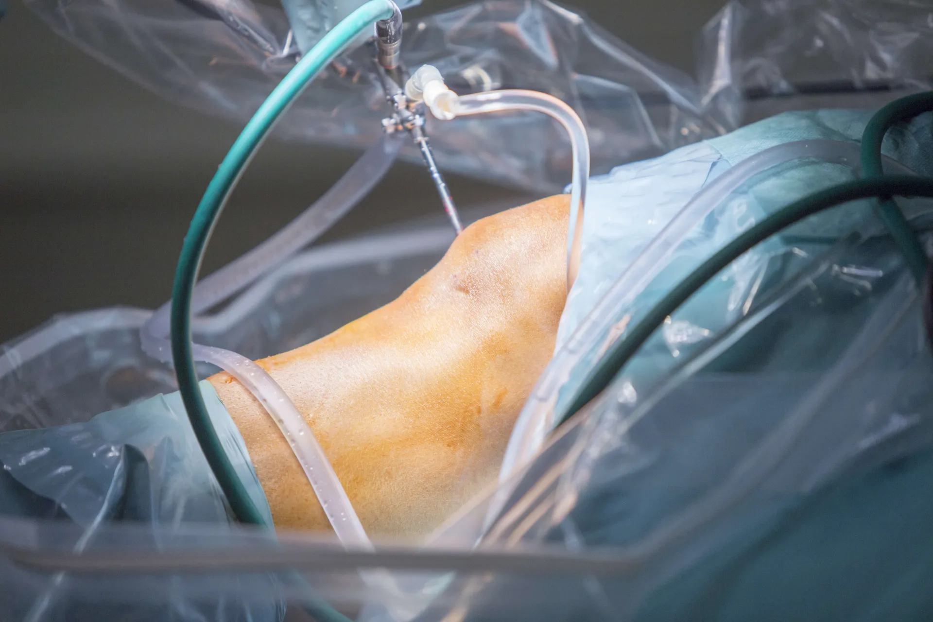 Close-up Knee Surgery