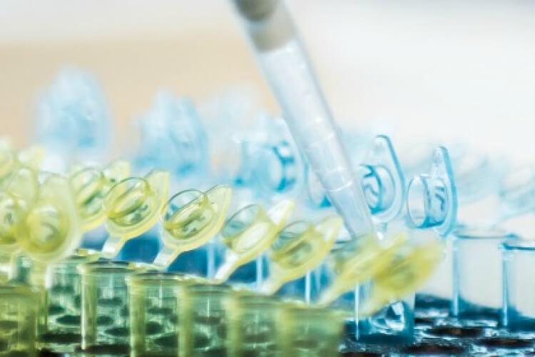 A row of yellow plastic lidded tubes in front of a row of blued plastic lidded tubes with the tip of a pipette dispensing liquid.