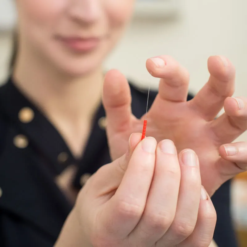 person holding an acupuncture needle