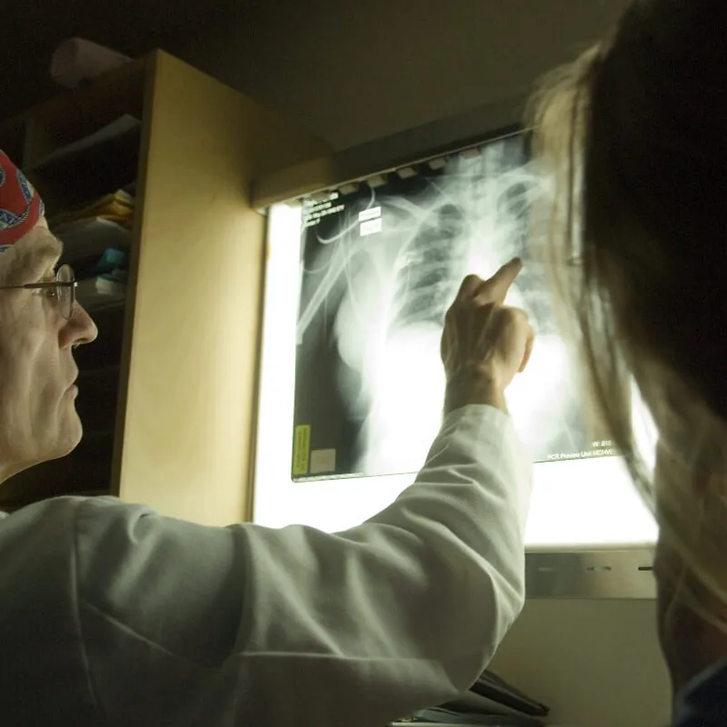 doctor pointing at an xray of lungs