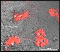 Microscopic image of live lung cell with tumors indicated in red