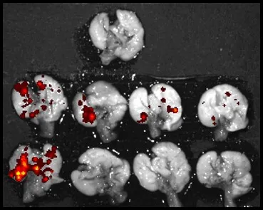 Microscope Image of mouse lungs with cancer tumors indicated in red