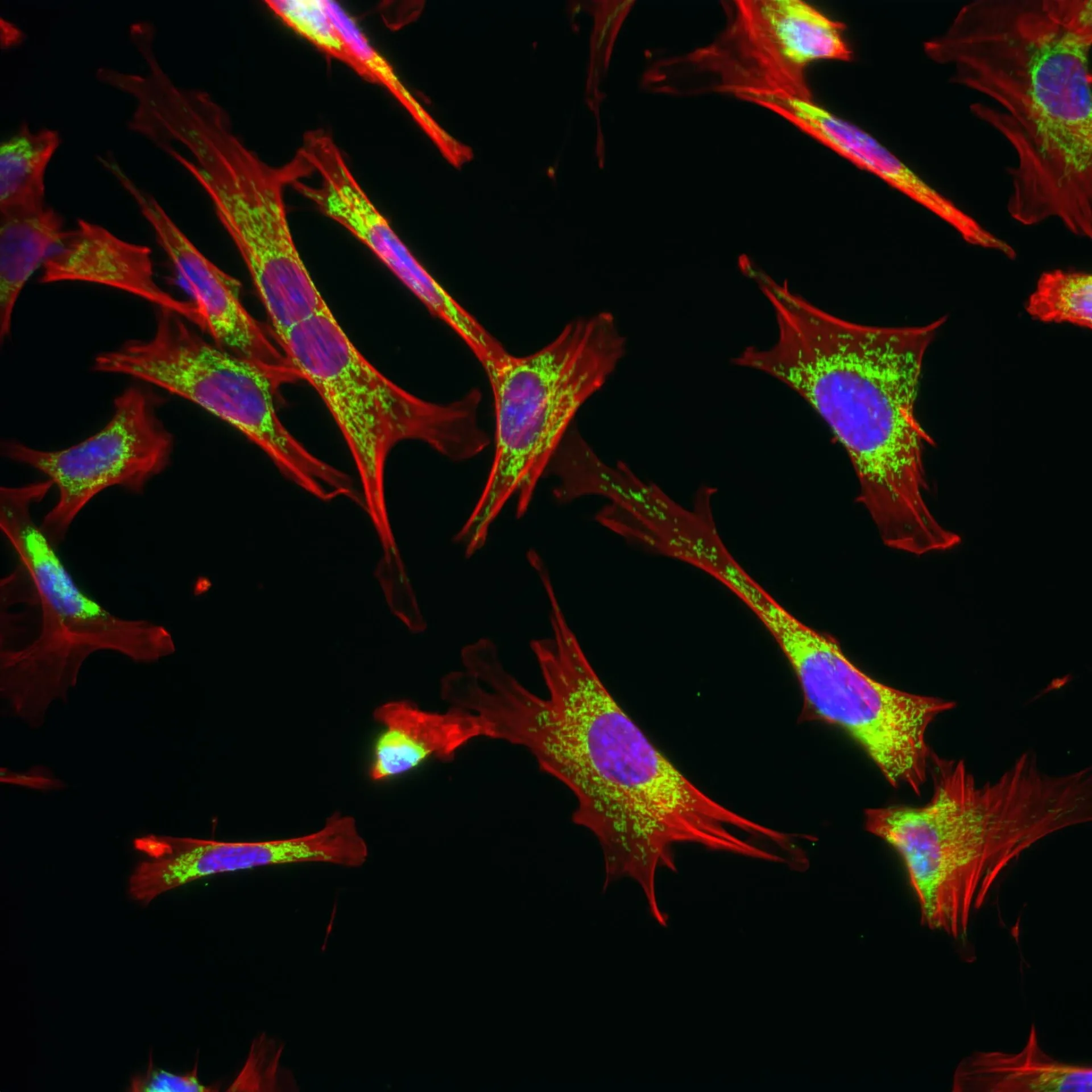 Immunofluorescent image of mouse fibroblasts to visualize intracellular structures. Red = Actin Cytoskeleton, Blue = Nucleus, Green = Mitochondria. Credit: Nate Shannon, Ph.D., Postdoctoral Scholar in Cunniff Lab