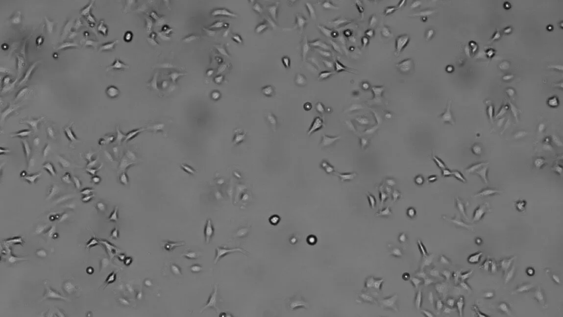 Lung cells under 400X magnification