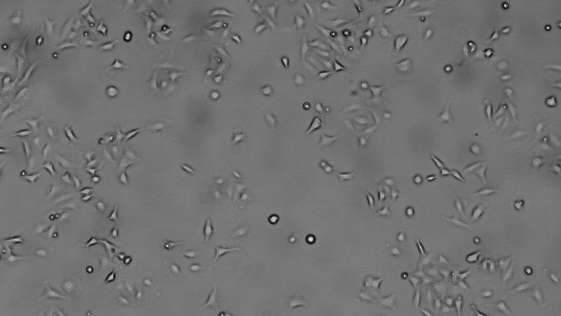 Lung cells under 400X magnification
